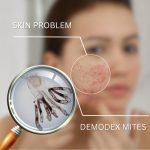 demodex life cycle