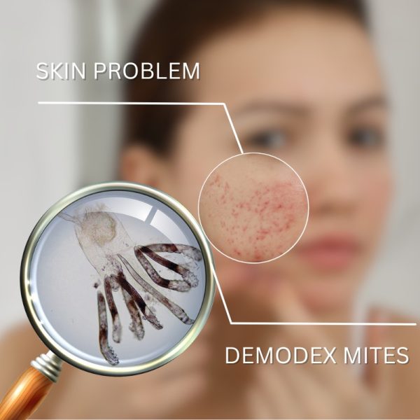 demodex life cycle