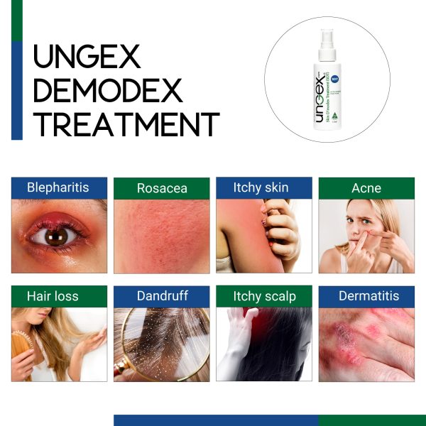 SDT Ungex Demodex Treatment