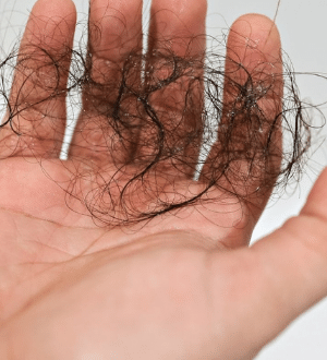 Human hair best sale hair follicle parasite