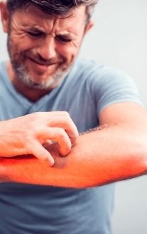 Itchy skin caused by demodex mites