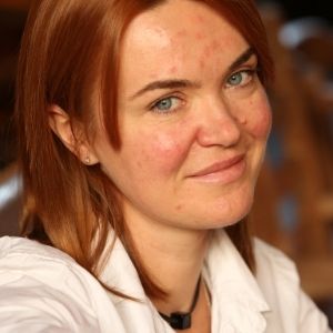 Rosacea symptoms