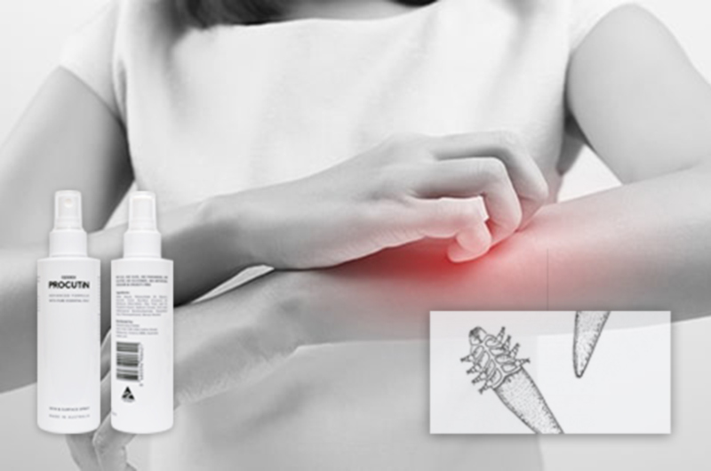 crawling sensation ozidex