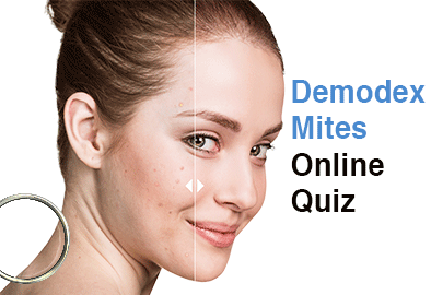 online demodex test