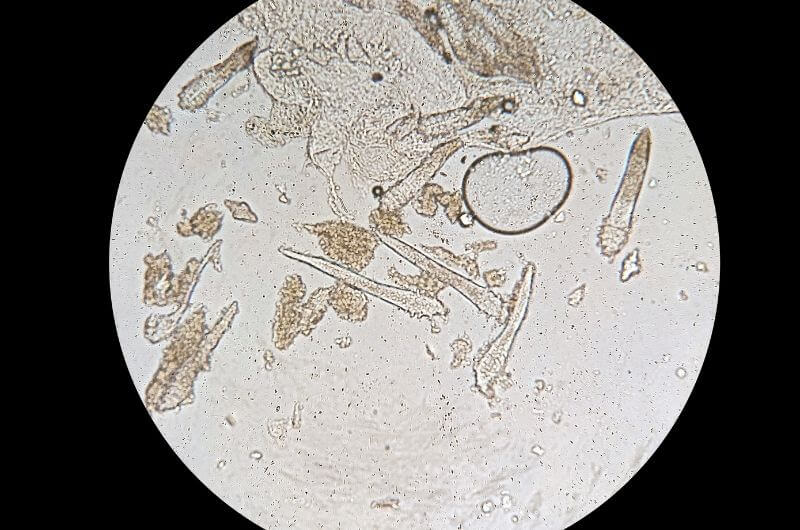 demodex brevis