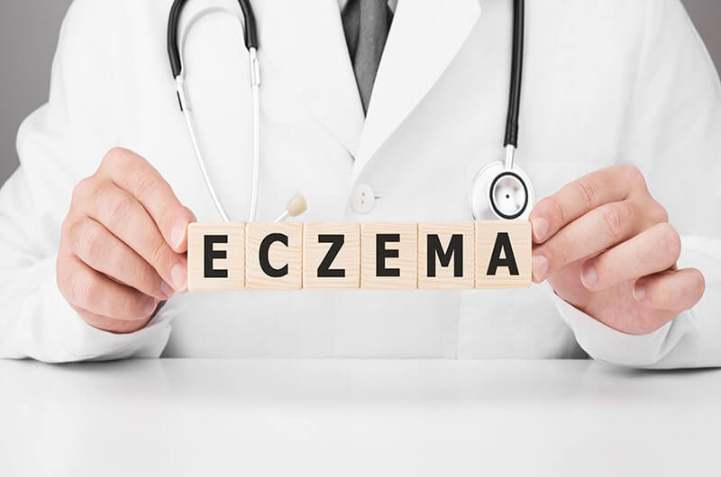 eczema causes