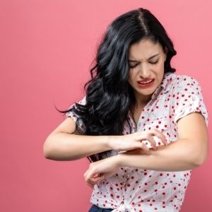 eczema