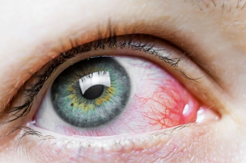 Eye mite