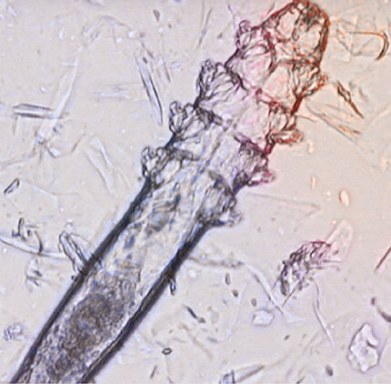 demodex mite