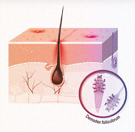 demodex mite