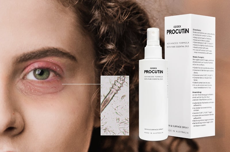 red skin around the eyes
