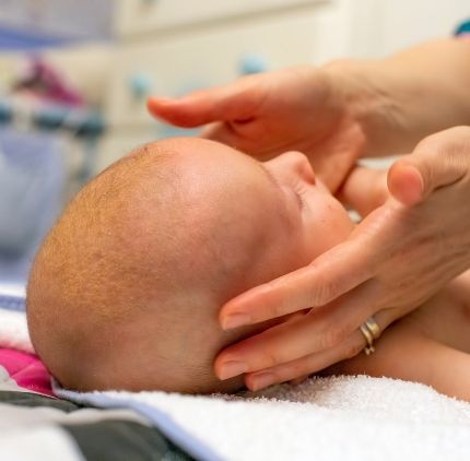 cradle cap in infants | ozidex