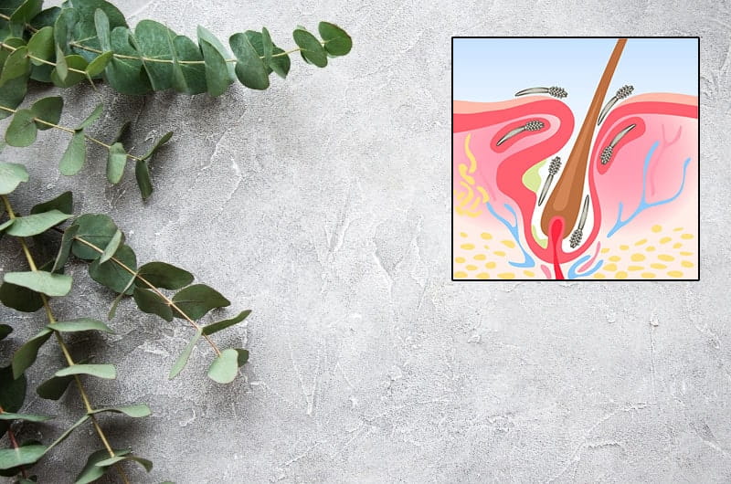 eucalyptus and demodex