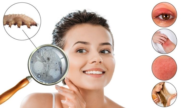 Demodex test and diagnostic methods of demodex mites-Ozidex