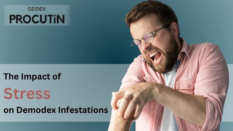 The Impact of Stress on Demodex Infestations
